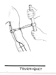 tourniquet